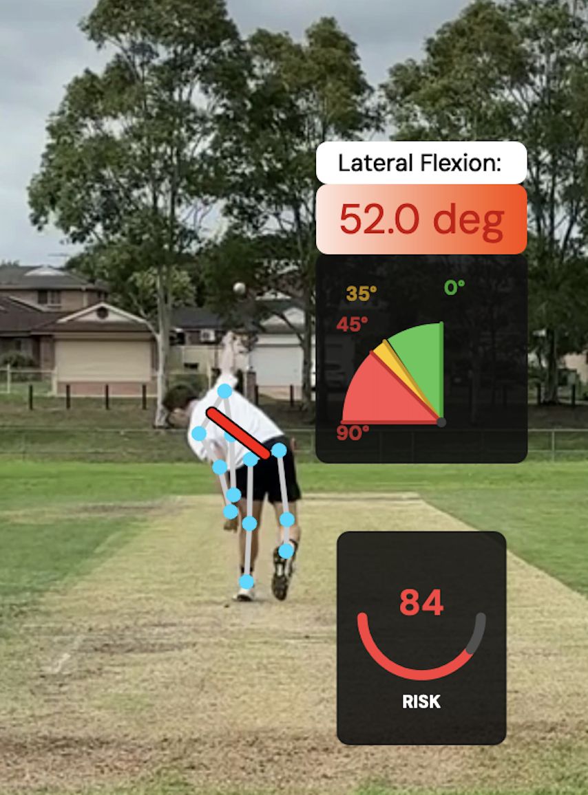Pitchwolf analysing a fast bowler's action, with a lateral flexion reading and an injury-risk score